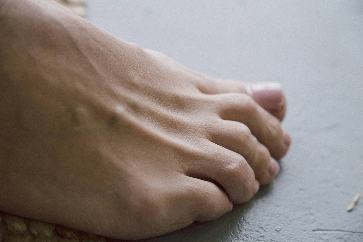 treatment product foot prevention tip exercise